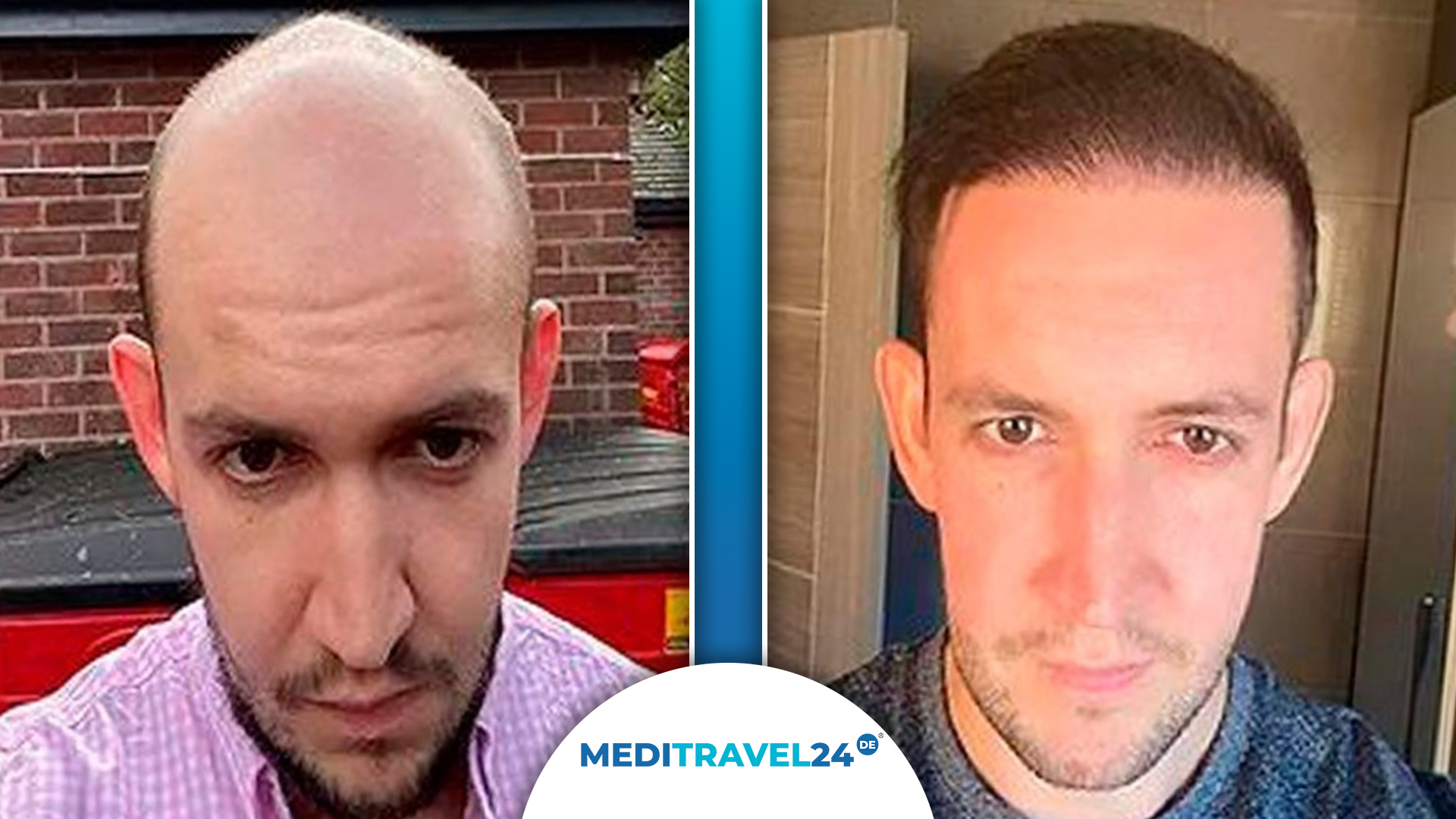 Vorher-Nachher Bild 1