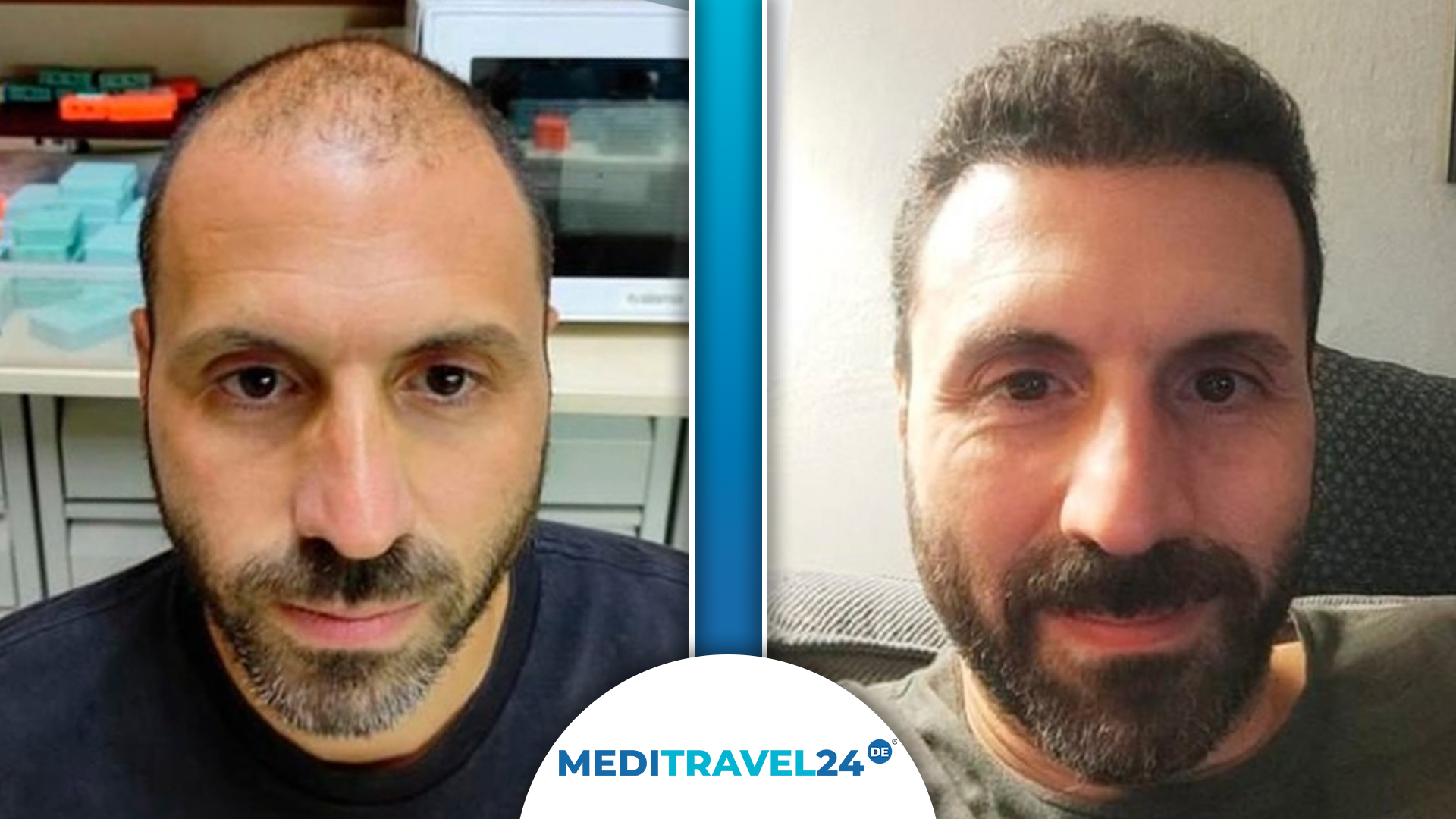 Vorher-Nachher Bild 2