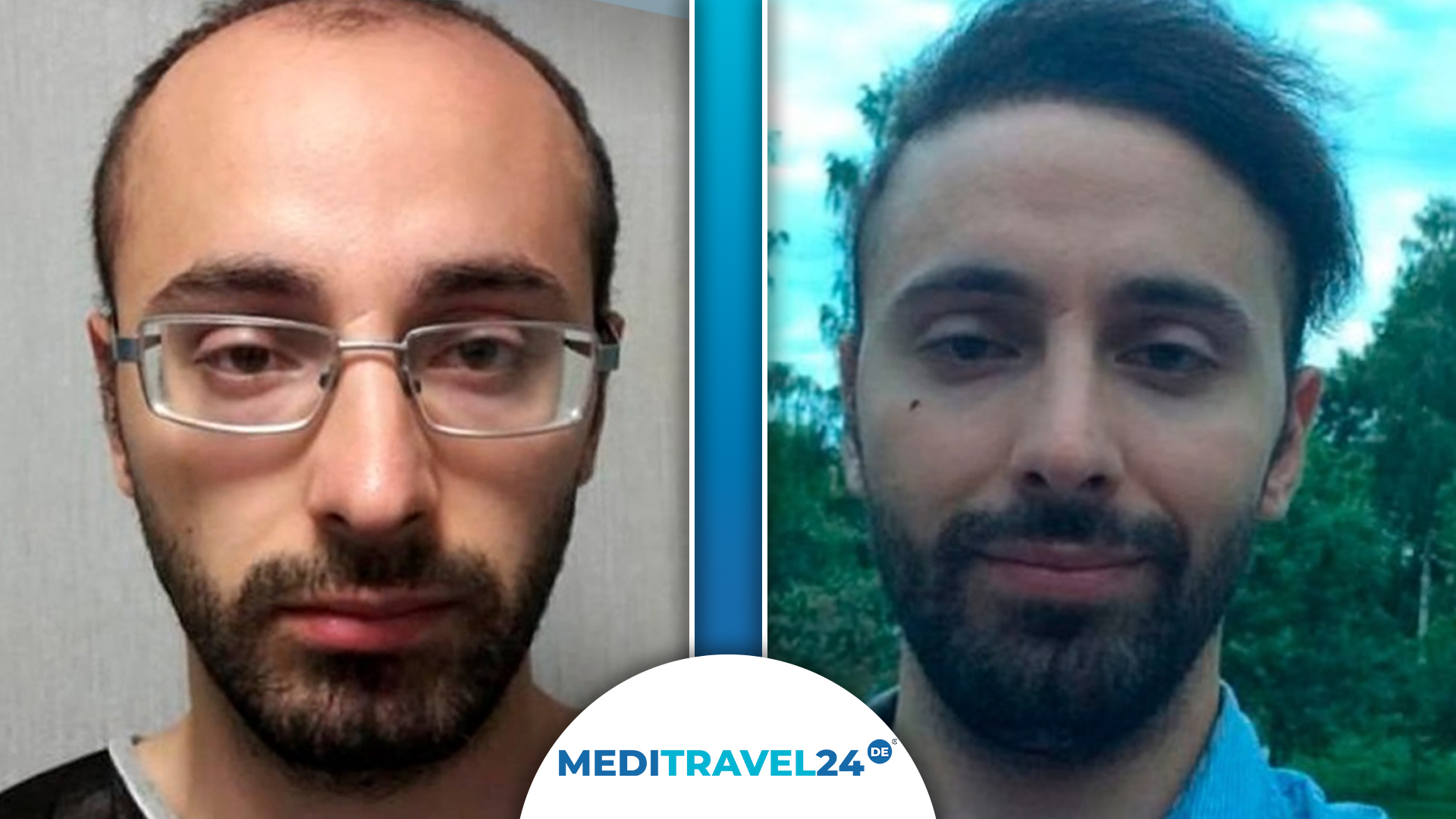 Vorher-Nachher Bild 3