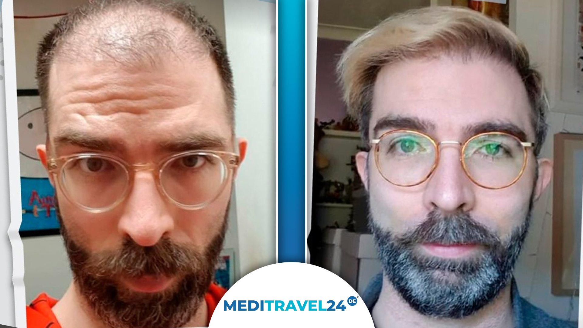 Vorher-Nachher Bild 4