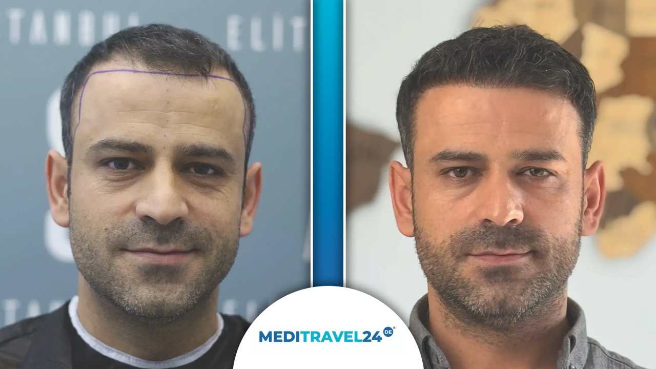 Vorher-Nachher Bild 1