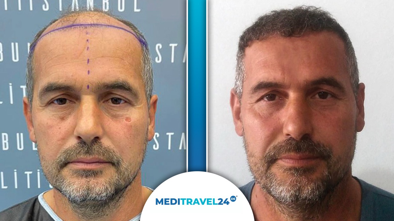 Vorher-Nachher Bild 2