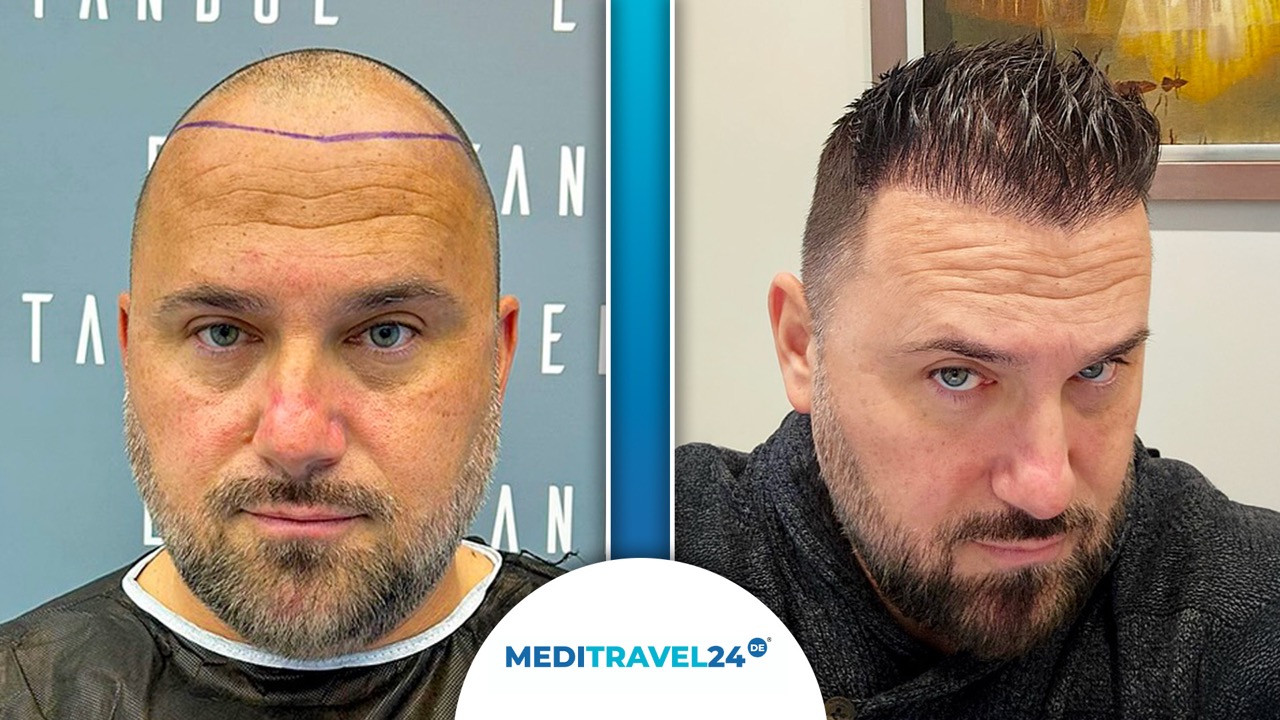 Vorher-Nachher Bild 3