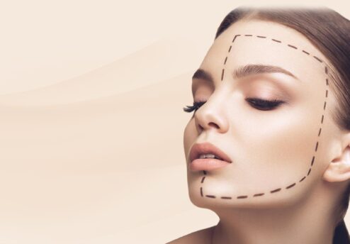 facelifting